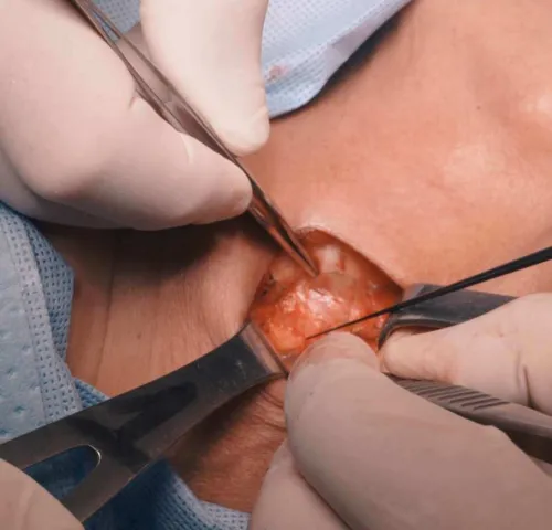 Cirugia 2